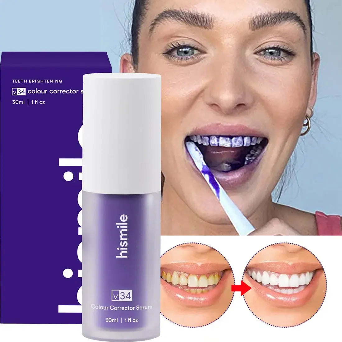 Blanqueador Dental Hismile